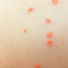 Uczulenie na gluten: objawy, przyczyny i skuteczna pielęgnacja cery